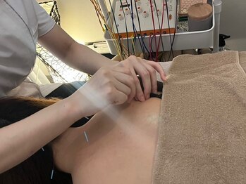 ハリサロンドオフ 心斎橋店(hari salon de off)の写真/【梅雨の不調に】どんより季節に出やすい頭痛・だるさ・自律神経の乱れに鍼灸×整体で内側から徹底ケア！
