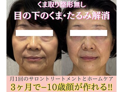 アディス 心斎橋(ADISE)の写真