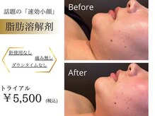 クイーンズ ピュア 新宿本店(Queen's Pure)の雰囲気（最新脂肪分解セラム×小顔マシン×小顔マッサージの最強コラボ◎）