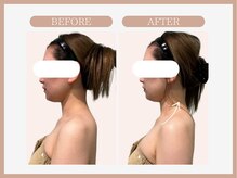 スリムライン 八戸店(The Slim Line)/before→after