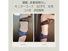 キセキ KISEKI リラクゼーションの雰囲気(90分モニターコース!1週間に2回ペースで、ぐっと引き締まる!)