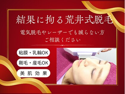 美容脱毛専門サロン エピラージュ 新宿店(Epilage)の写真