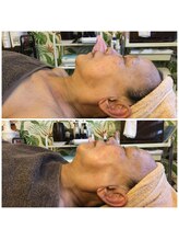 ロータス(Lotus)/60代　(上)ビフォー(下)アフター