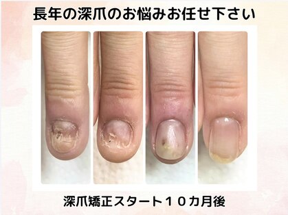 アニューの写真