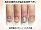 アニューの写真