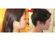 サロンドエステケイワイ(de KY)/フェイシャル☆小顔・タルミ改善