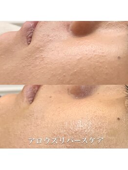 トータルエステティック ビューティスト 足利店(Total Easthetic Beautist)/