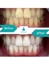 ティンクルホワイト 成田店/ビフォーアフター２