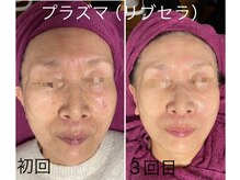 ビューティーサロン キャンディ 海老名(Candy)/