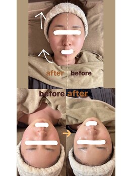 ラ ブリエ(La Briller)/究極小顔+ララピール+ゲルマスク