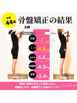 セレンディピティ 刈谷店(Serendipity)/【美容骨盤矯正】痩身ダイエット