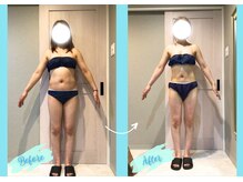 千歳の女神 三河安城店/【施術風景】Before/After