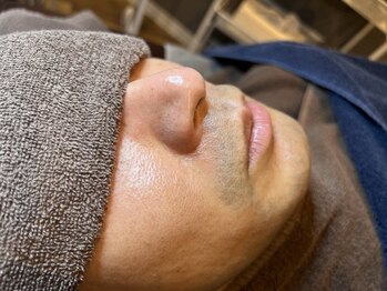 シェリール(Cherir)の写真/《メンズの新常識！》お顔の清潔感アップ☆お肌に優しい脱毛で敏感肌の方もOK！脱毛デビューにもオススメ♪