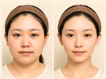オリエンタルローザ 表参道(Oriental Rosa)