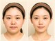 オリエンタルローザ 表参道(Oriental Rosa)の写真/最上位インディバER200[インディバフェイシャル 75分]幹細胞増殖×リフトUP！お顔～ヘッドケアまで¥9800★