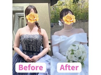ボディキュア ブライダル美容整体 大阪梅田/【華奢見え】デコルテ美人