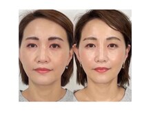 健美プラス いわき店(kenbi-plus)