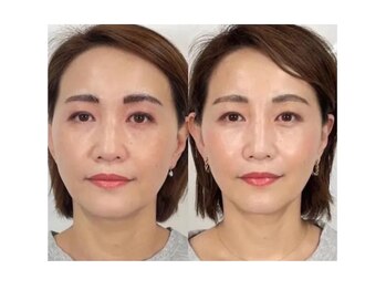 健美プラス いわき店(kenbi-plus)