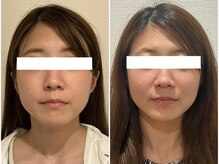 美容整体ウェリナ あま甚目寺院/小顔矯正/骨盤矯正/美脚サロン