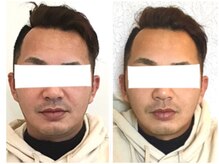 美容整体ウェリナ あま甚目寺院/小顔矯正/骨盤矯正/美脚サロン