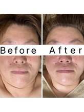 アンシャンテ(Enchant)/メリハリをプラスして立体感UP！