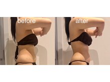 エラ(Ella)の雰囲気（次世代機能搭載の最新マシン完備◇痩身もリアップも！）