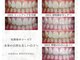 エミリアホワイトニング(EMIRIA WHITENING)の写真