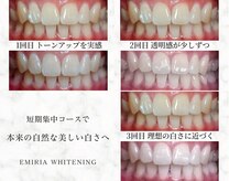 エミリアホワイトニング(EMIRIA WHITENING)