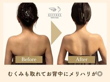 ラフリー 神戸三宮院(RUFFREE)/筋膜リリースでむくみ知らず