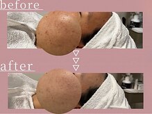サンラックスサロン 岐阜(SANlux Salon)の雰囲気（解剖学に基づいた、たしかな手技で一回でも高い効果実感）