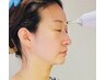 【エクソソーム】しわケア（ほうれい線・眉間・目の間）40～50発 通常￥9000