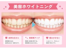 リッシュ(RICHE)の雰囲気(人気急上昇中☆美容ホワイトニング導入!9月中旬より予約スタート)