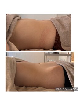 リノアンド(Lino&)の写真/「巡る腸、整う身体、輝く肌。」