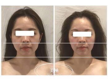 美極 銀座店/銀座/小顔コルギ/小顔矯正