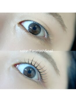 サロン エフ(salonF)/ビフォーアフター