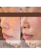 凪眠/小顔リンパフェイシャルの効果20