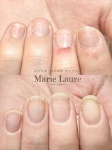 マリーロール 淀屋橋本店(Marie Laure)/自爪育成/深爪矯正/ネイルケア