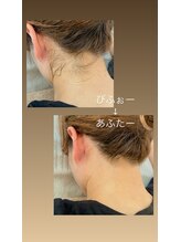 ノフ 恵比寿(noff)/光脱毛（うなじ）