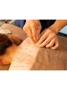 鍼灸施術を受けたい