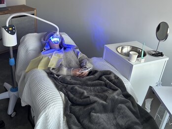 ネーム(Nemu)の写真/《医療機関と提携ホワイトニングサロン!》歯のホワイトニング/唇の発色ケアや咀嚼筋のコリ防止リンパも有◎