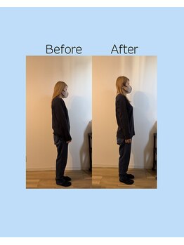 ヨスガ(YoSuGa)/姿勢矯正ビフォーアフター