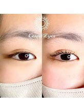 チュラアイズ(CerahEyes)/【お客様ビフォーアフター】
