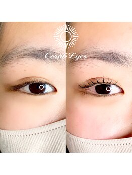チュラアイズ(CerahEyes)/【お客様ビフォーアフター】