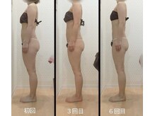 ローズルームの雰囲気（運動不足/代謝不良/悪姿勢/肥満を改善したい方◎美ボディー痩身）