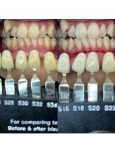 トウキョウスワーズ 池袋店(TOKYO SWRS)/#ホワイトニング #池袋 #渋谷