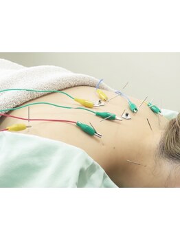 鍼灸施術を受けたい