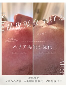 フル(Full)/美肌プログラム