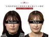 【圧倒的即効性と持続性を兼ね備えた小顔術】美容鍼or小顔矯正×高周波