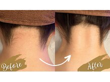 チャンティック(Cantik)/うなじケア