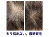 幹細胞で細く少なくなった毛を改善